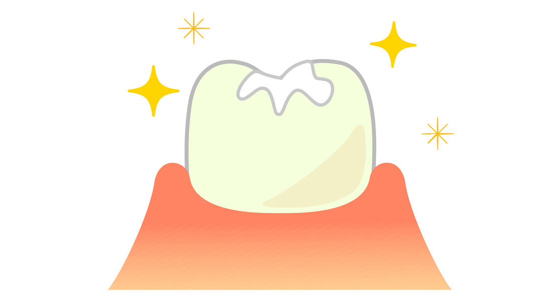 中原区・平間駅のシーラント