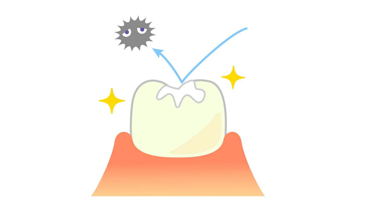 中原区・平間駅のシーラント
