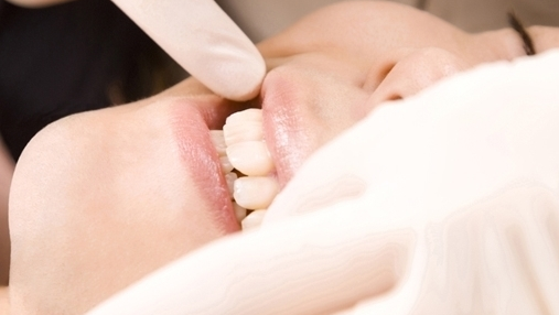 中原区・平間駅のホームホワイトニング