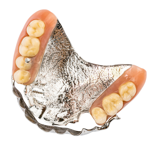 中原区・平間駅の自費の入れ歯、義歯、ノンクラスプデンチャー、金属床義歯