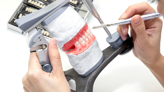 中原区・平間駅の自費の入れ歯、義歯、ノンクラスプデンチャー、金属床義歯