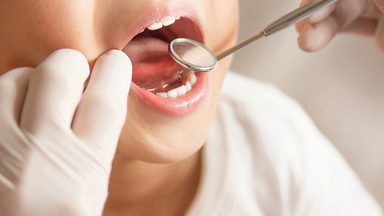 中原区・平間駅のシーラント