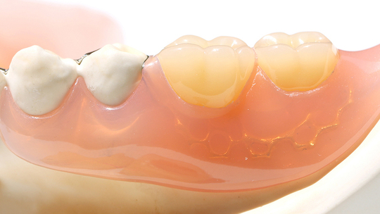 中原区・平間駅の入れ歯の治療