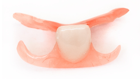 中原区・平間駅のノンクラスプデンチャー・部分入れ歯・部分義歯