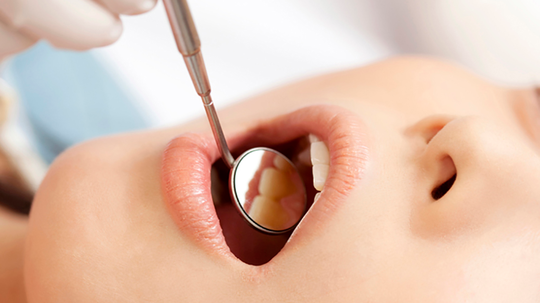 中原区・平間駅のノンクラスプデンチャー