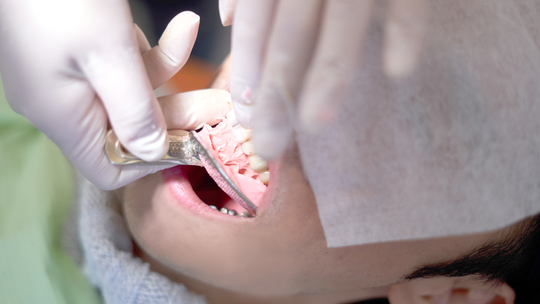 中原区・平間駅のホームホワイトニング