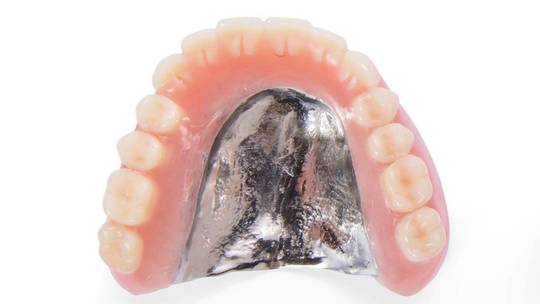 中原区・平間駅の自費の入れ歯、義歯、ノンクラスプデンチャー、金属床義歯