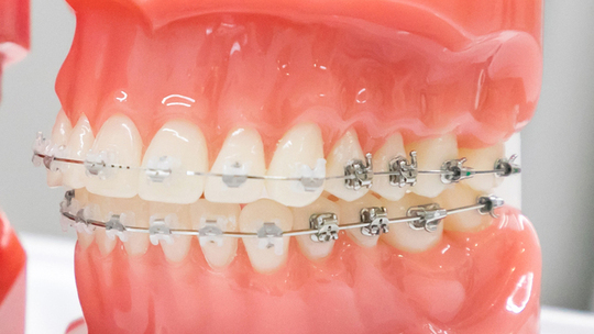 中原区・平間駅の小児矯正